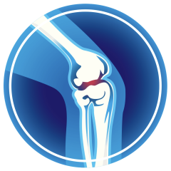 Rodilla